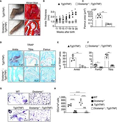 Dendritic cell-specific transmembrane protein is required for synovitis and bone resorption in inflammatory arthritis